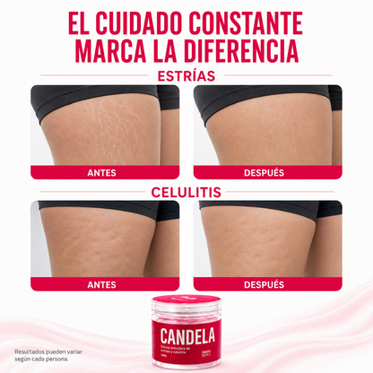 CANDELA - CREMA ANTI ESTRIAS Y ANTI CELULITIS
